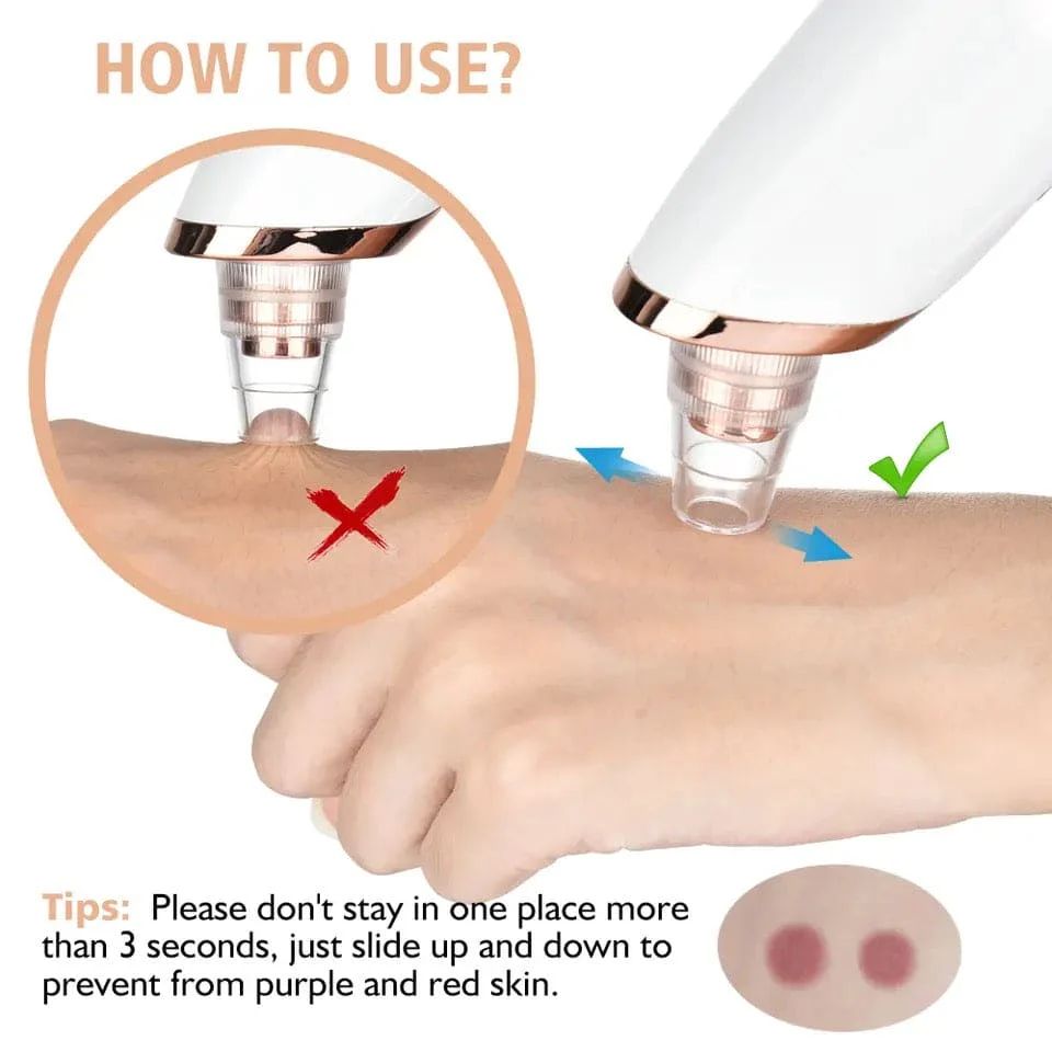 5 In 1 Electric Blackhead Acne Oil Remover